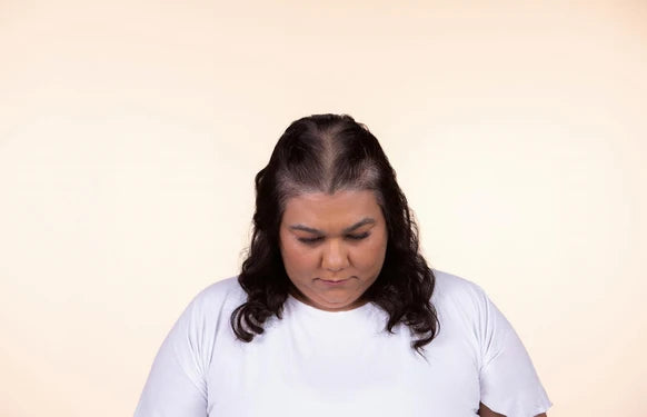 Before application, visible scalp along a dark-haired centre parting